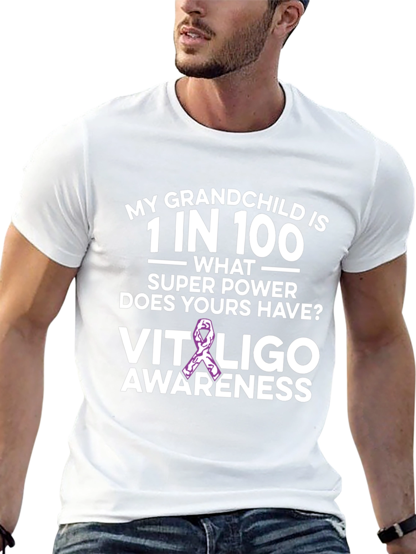 Vitiligo Awareness T-Shirt: Grandchild Support