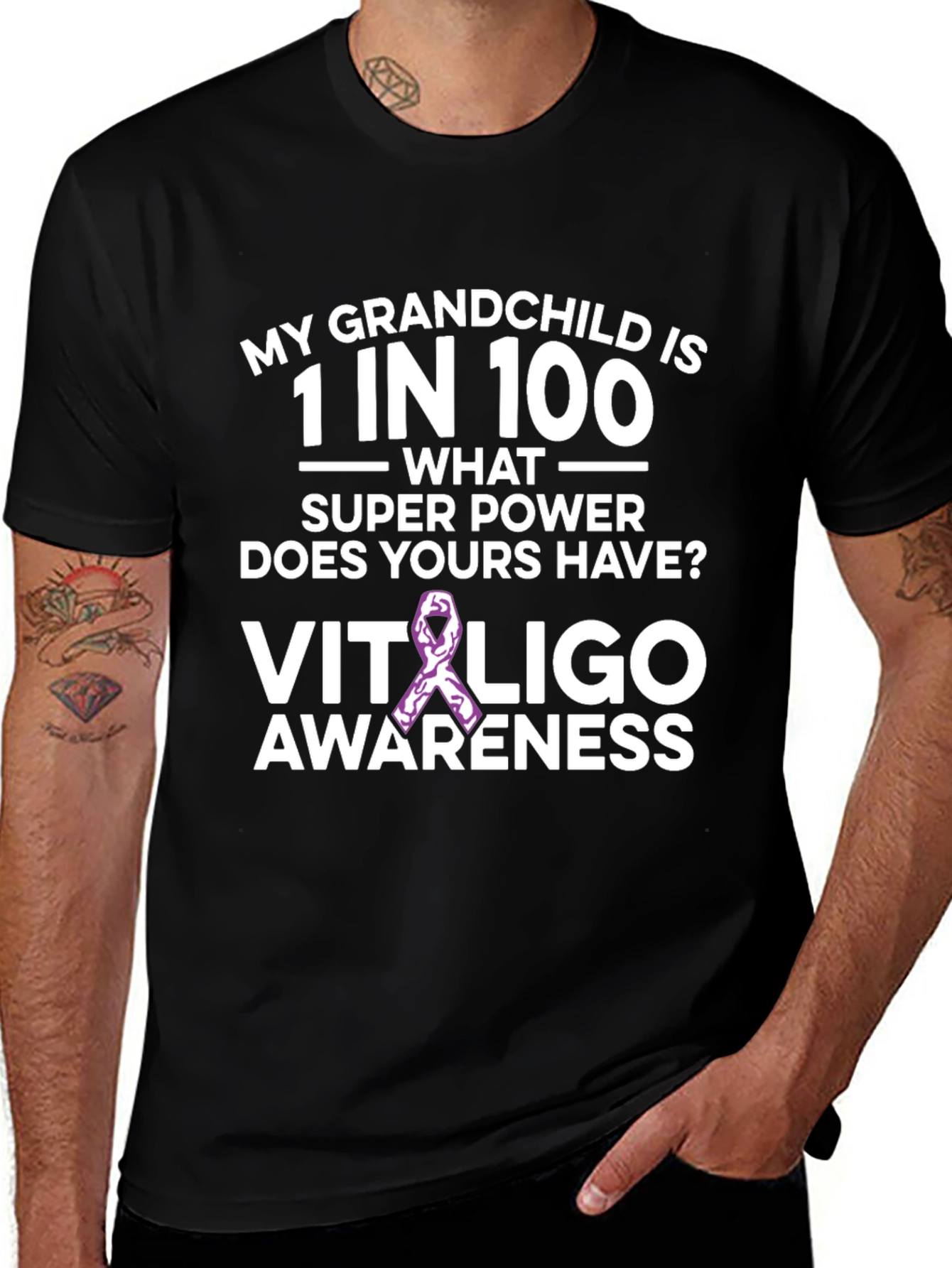 Vitiligo Awareness T-Shirt: Grandchild Support