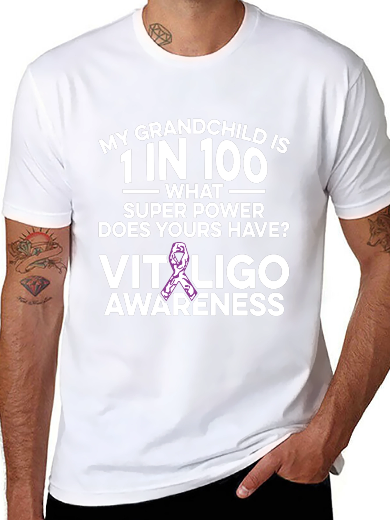 Vitiligo Awareness T-Shirt: Grandchild Support
