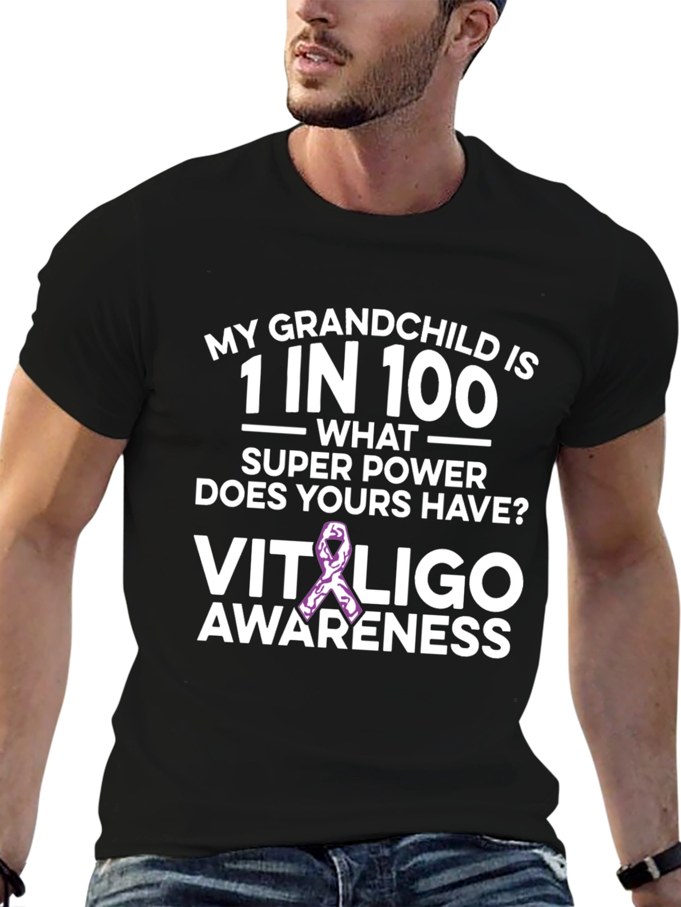 Vitiligo Awareness T-Shirt: Grandchild Support