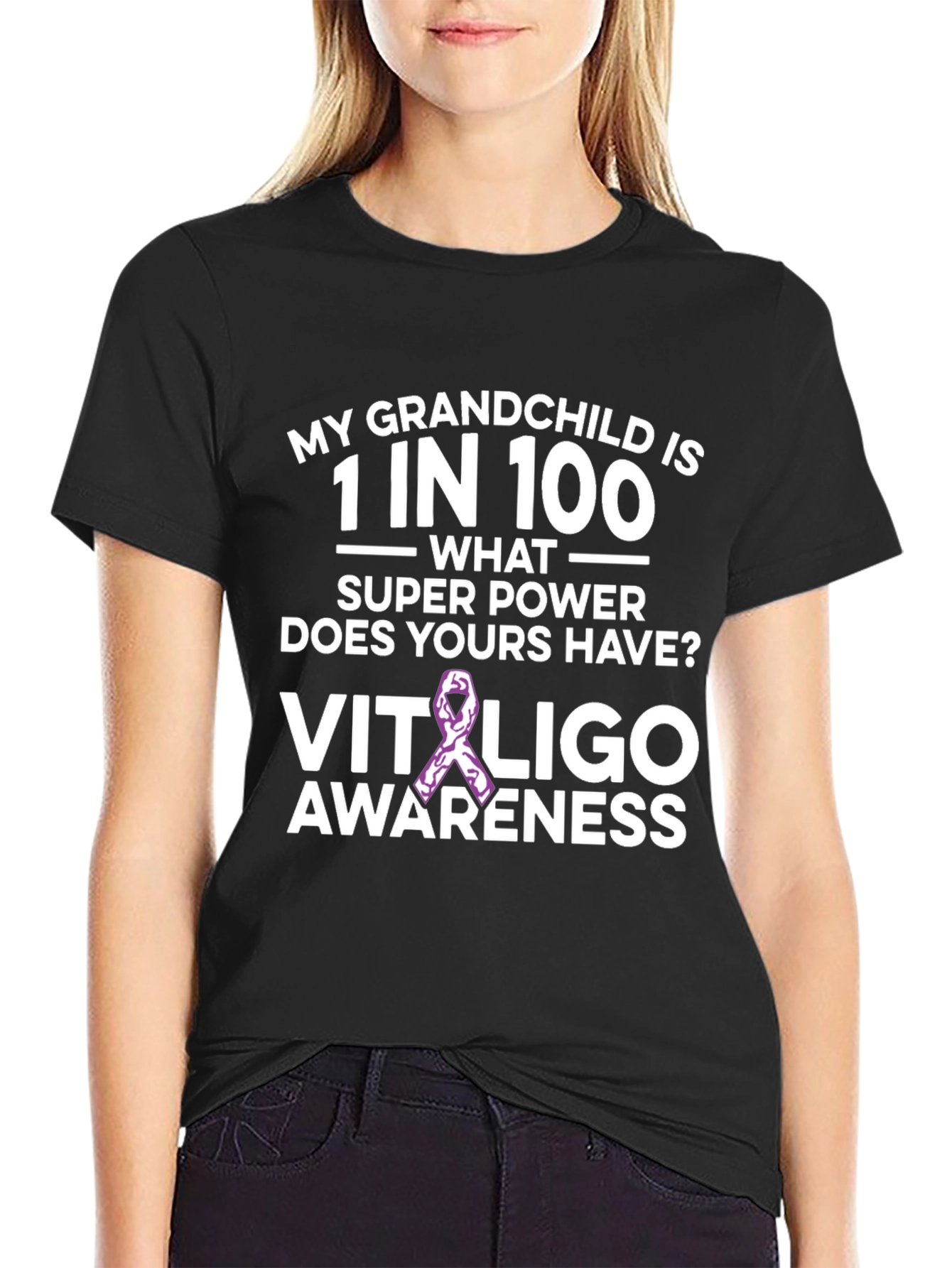 Vitiligo Awareness T-Shirt: Grandchild Support